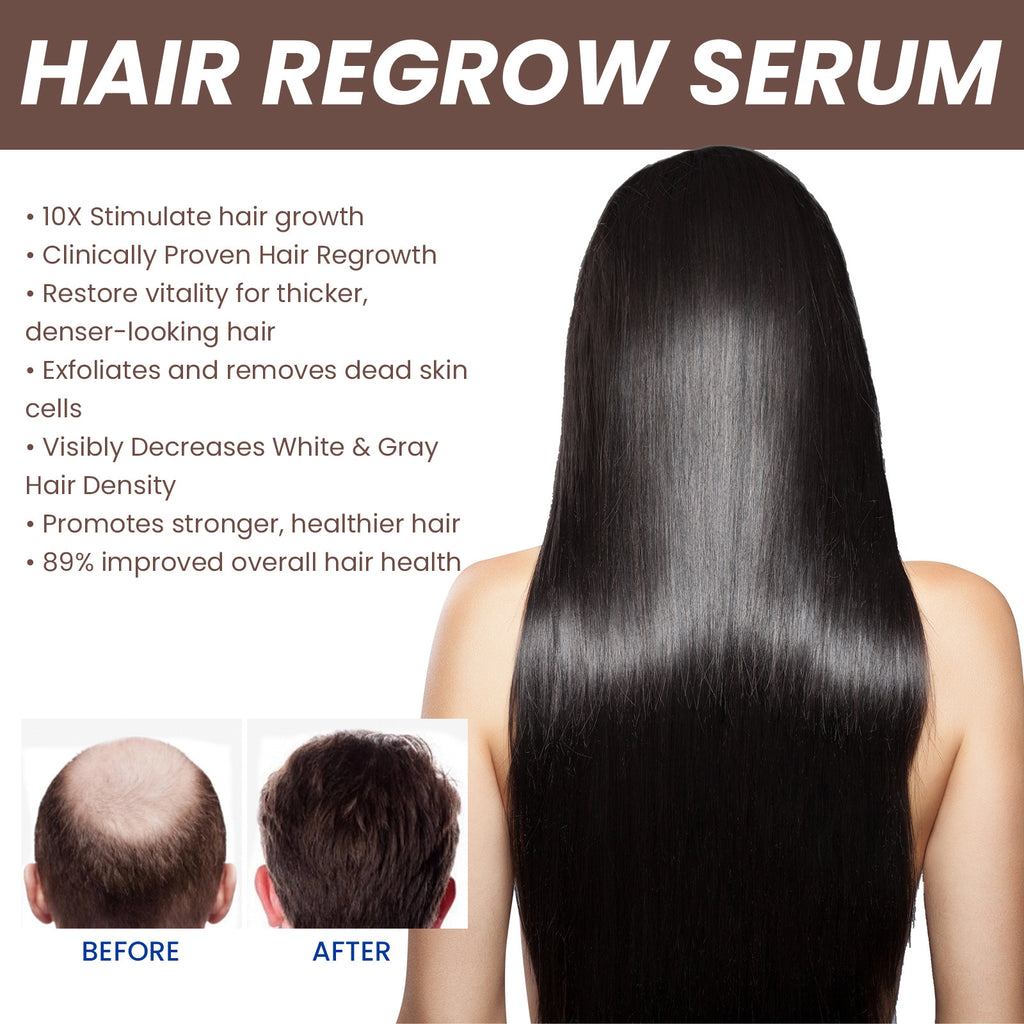 EELHOE Hair Dense Essence - Anti-Hair Loss Treatment & Hair Growth Serum