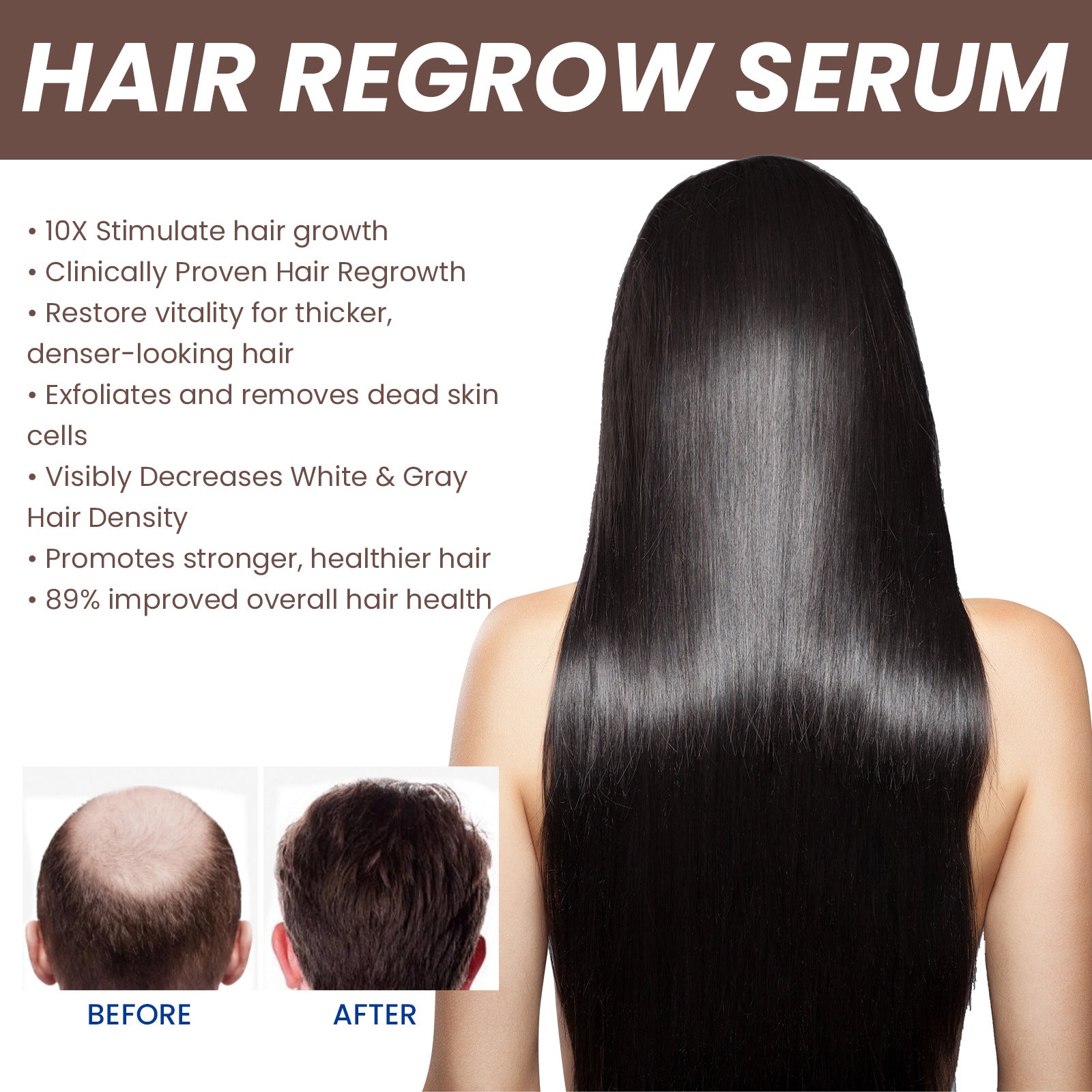 EELHOE Hair Dense Essence - Anti-Hair Loss Treatment & Hair Growth Serum