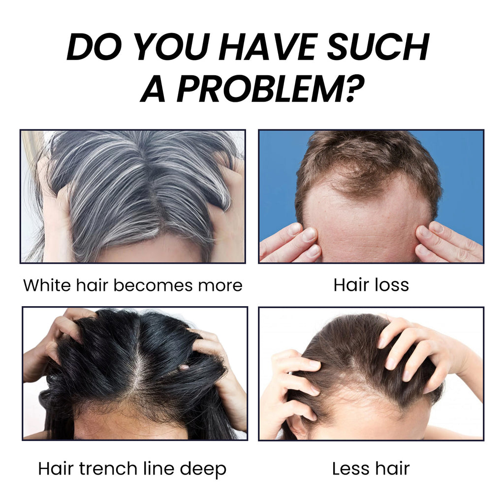 EELHOE Hair Dense Essence - Anti-Hair Loss Treatment & Hair Growth Serum