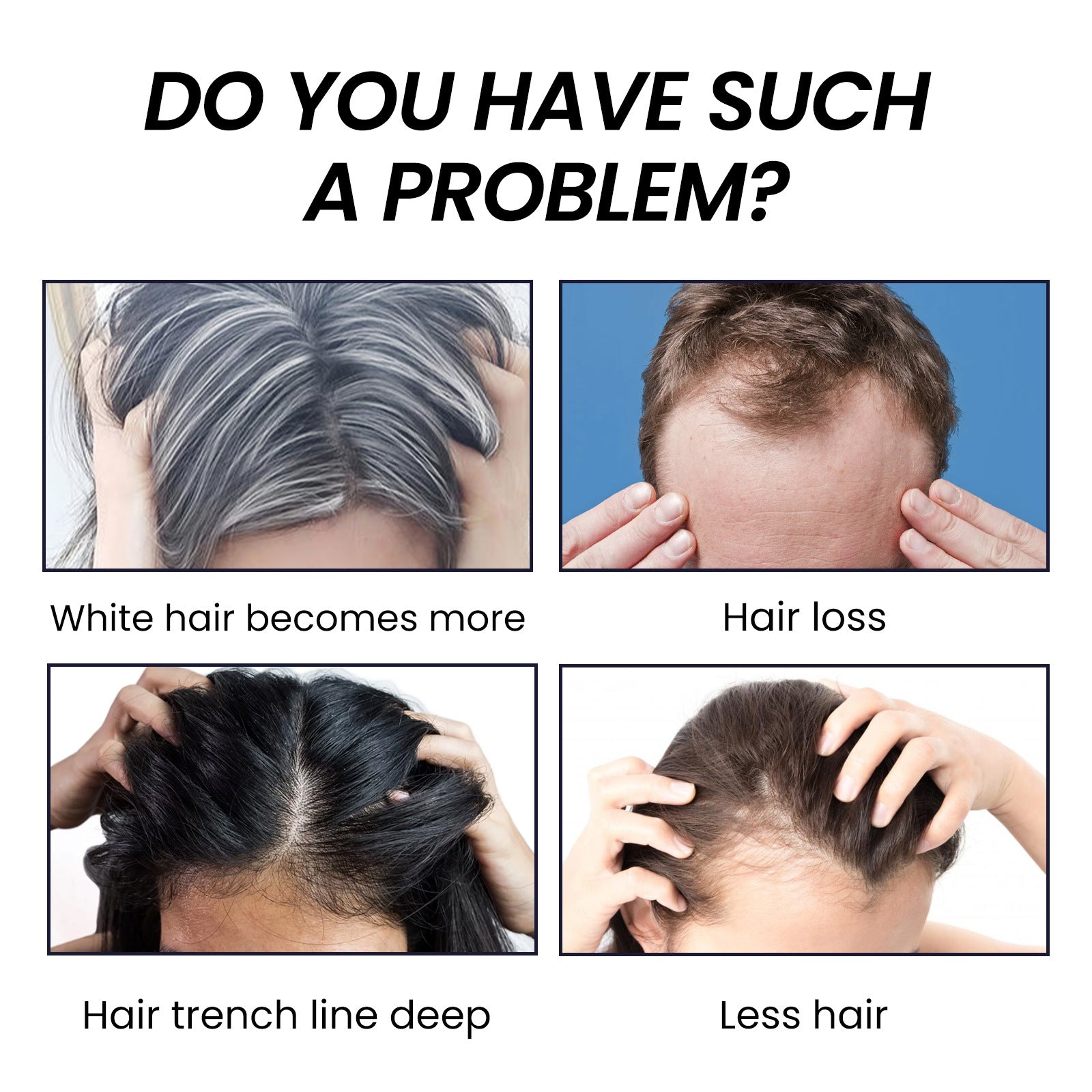 EELHOE Hair Dense Essence - Anti-Hair Loss Treatment & Hair Growth Serum