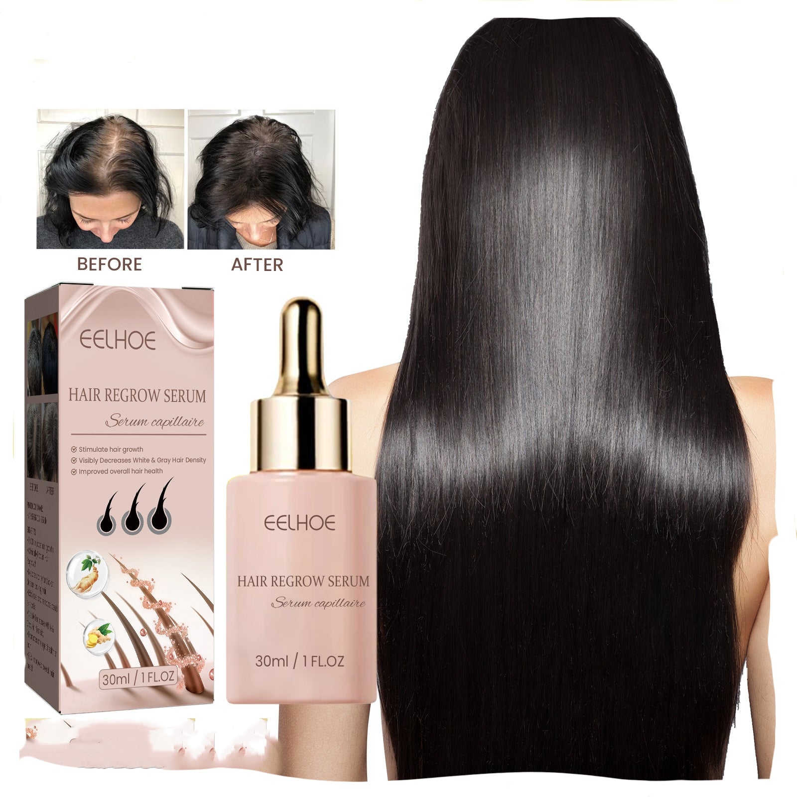 EELHOE Hair Dense Essence - Anti-Hair Loss Treatment & Hair Growth Serum